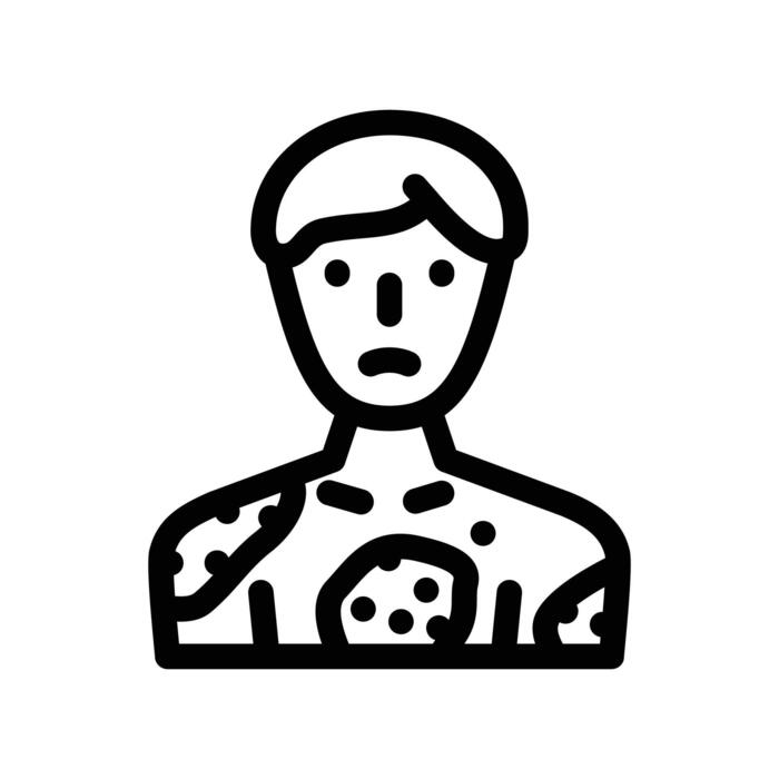 Psoriasis care Wellness Retreats